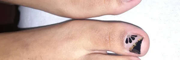 img of Uñas acrílicas: Técnica Francesa en Reversa