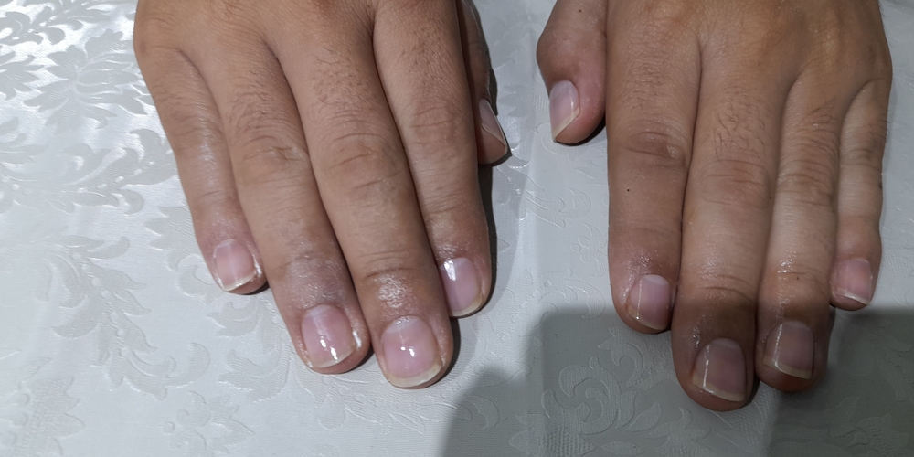 img of Uñas acrílicas: Técnica Francesa en Reversa