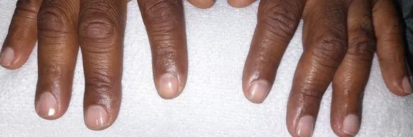 img of Uñas acrílicas: Técnica Francesa en Reversa
