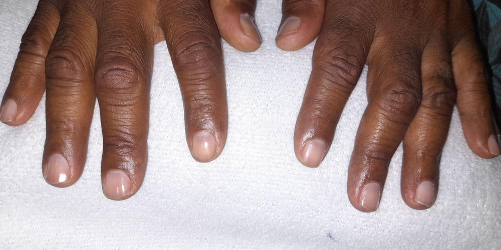 img of Uñas acrílicas: Técnica Francesa en Reversa