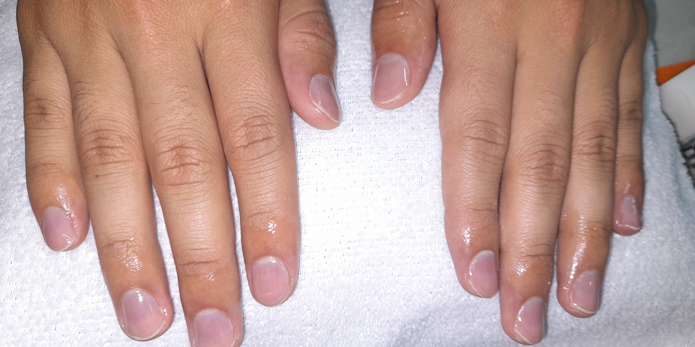 img of Uñas acrílicas: Técnica Francesa en Reversa