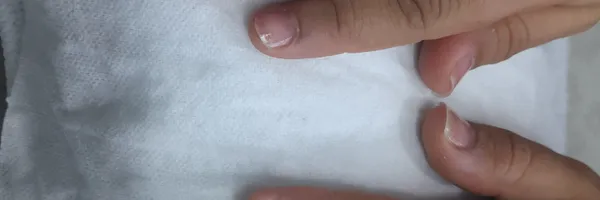 img of Uñas acrílicas: Técnica Francesa en Reversa