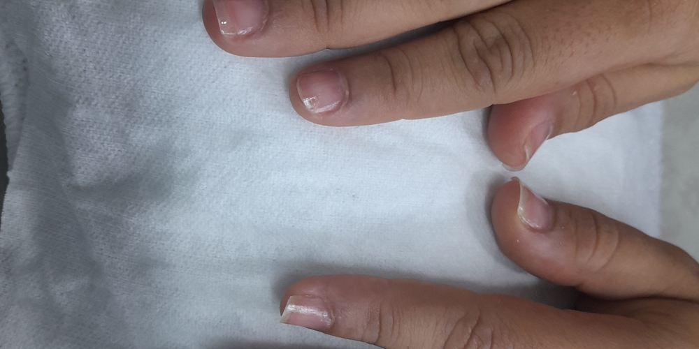 img of Uñas acrílicas: Técnica Francesa en Reversa