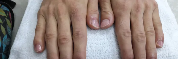 img of Uñas acrílicas: Técnica Francesa en Reversa