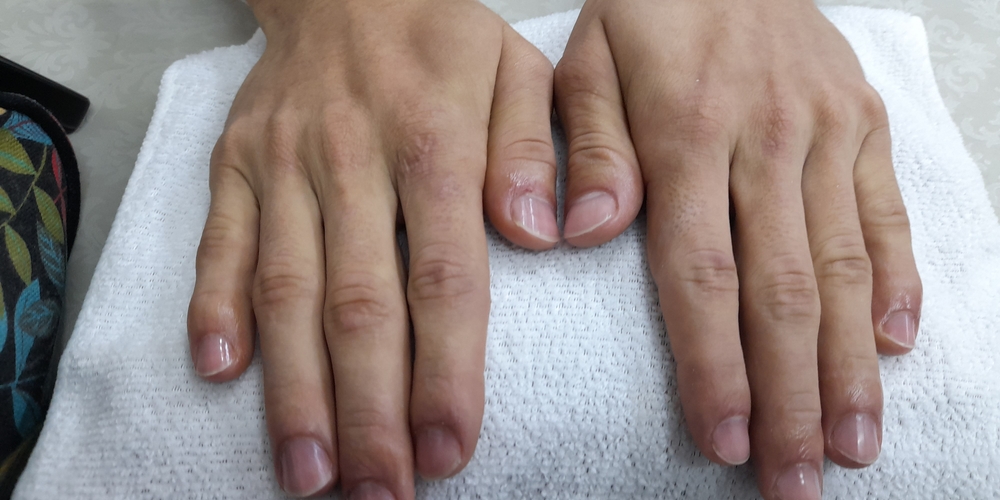 img of Uñas acrílicas: Técnica Francesa en Reversa