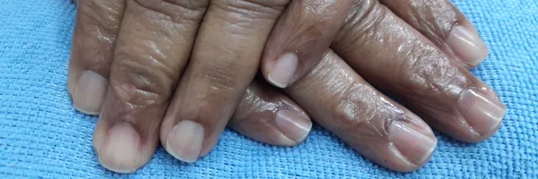 img of Uñas acrílicas: Técnica Francesa en Reversa