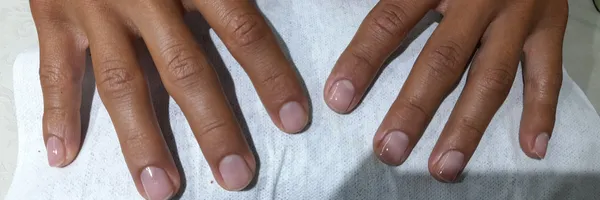 img of Uñas acrílicas: Técnica Francesa en Reversa